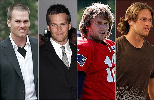 Tom Brady Hair Transplant pic