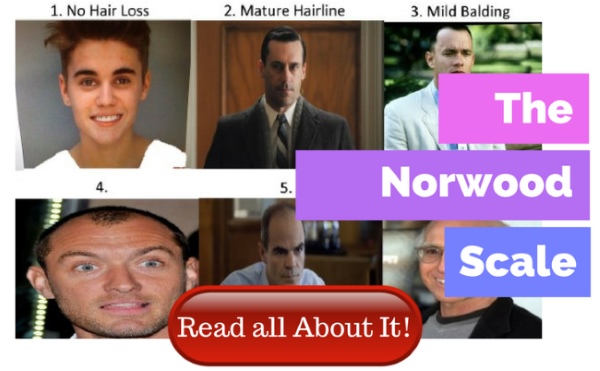 norwood scale image, 1 to bald